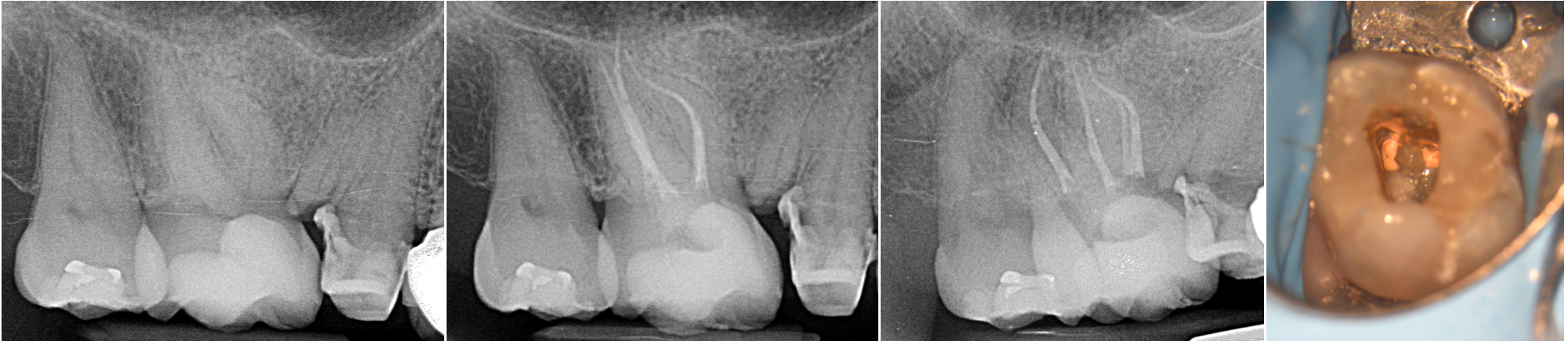 intarsio dentale