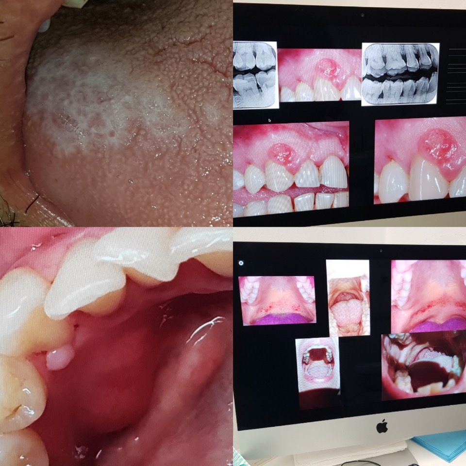 Patologia Orale_1